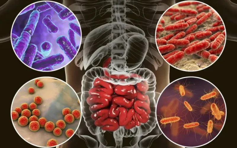 A guerra invisível na sua barriga: Fitoterapeuta explica por que o inchaço constante pode ser sinal de SIBO, SIFO ou Leaky Gut